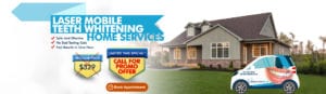 Laser Mobile Teeth Whiting Home Services– Call For Promo Offer (1)