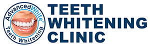 Teeth Whitening Toronto, Brampton, Richmond Hill, Markham