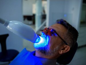laser teeth whitening cost