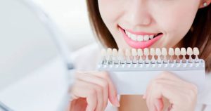 teeth whitening clinic - Advanced White Teeth Whitening Toronto