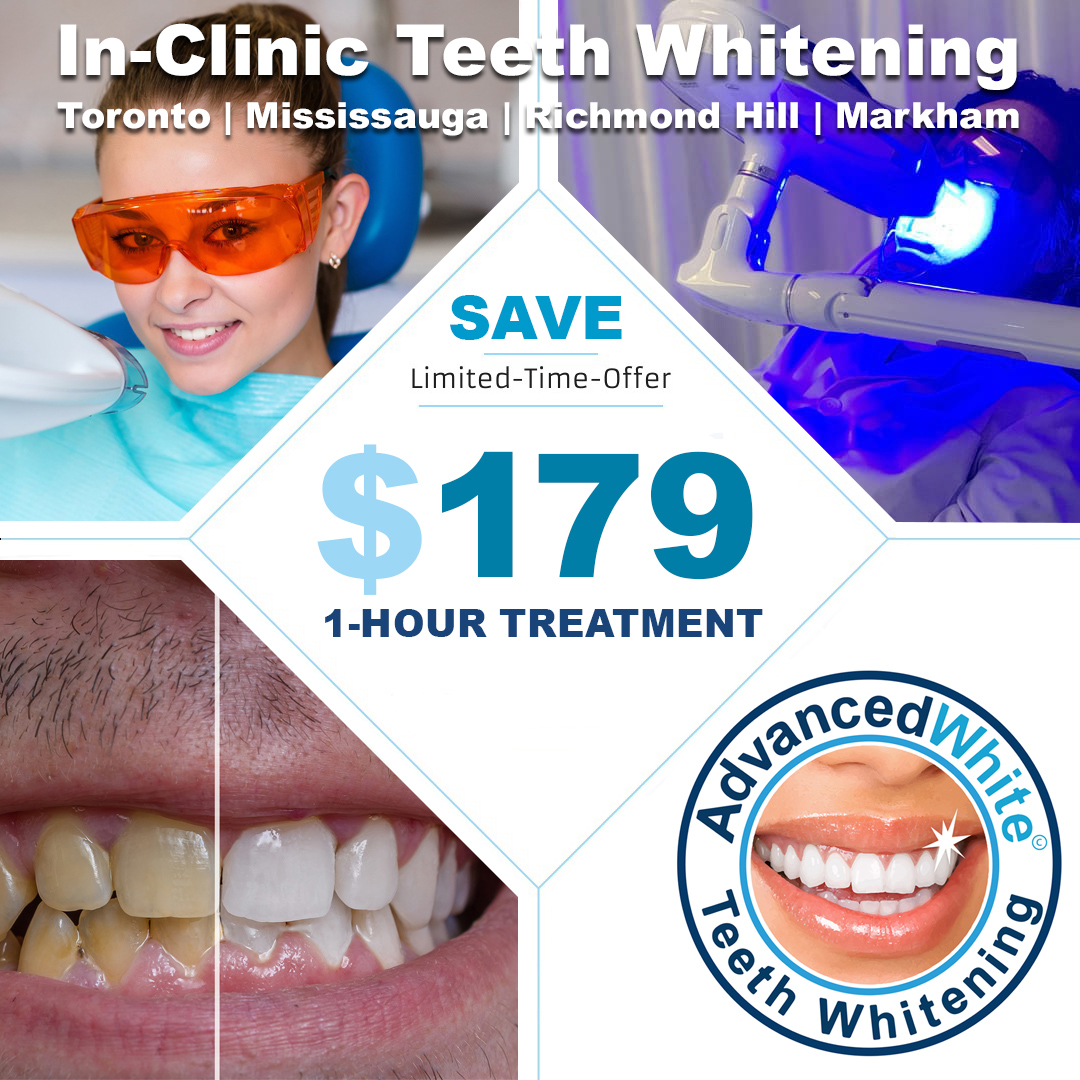 Teeth Whitening Toronto