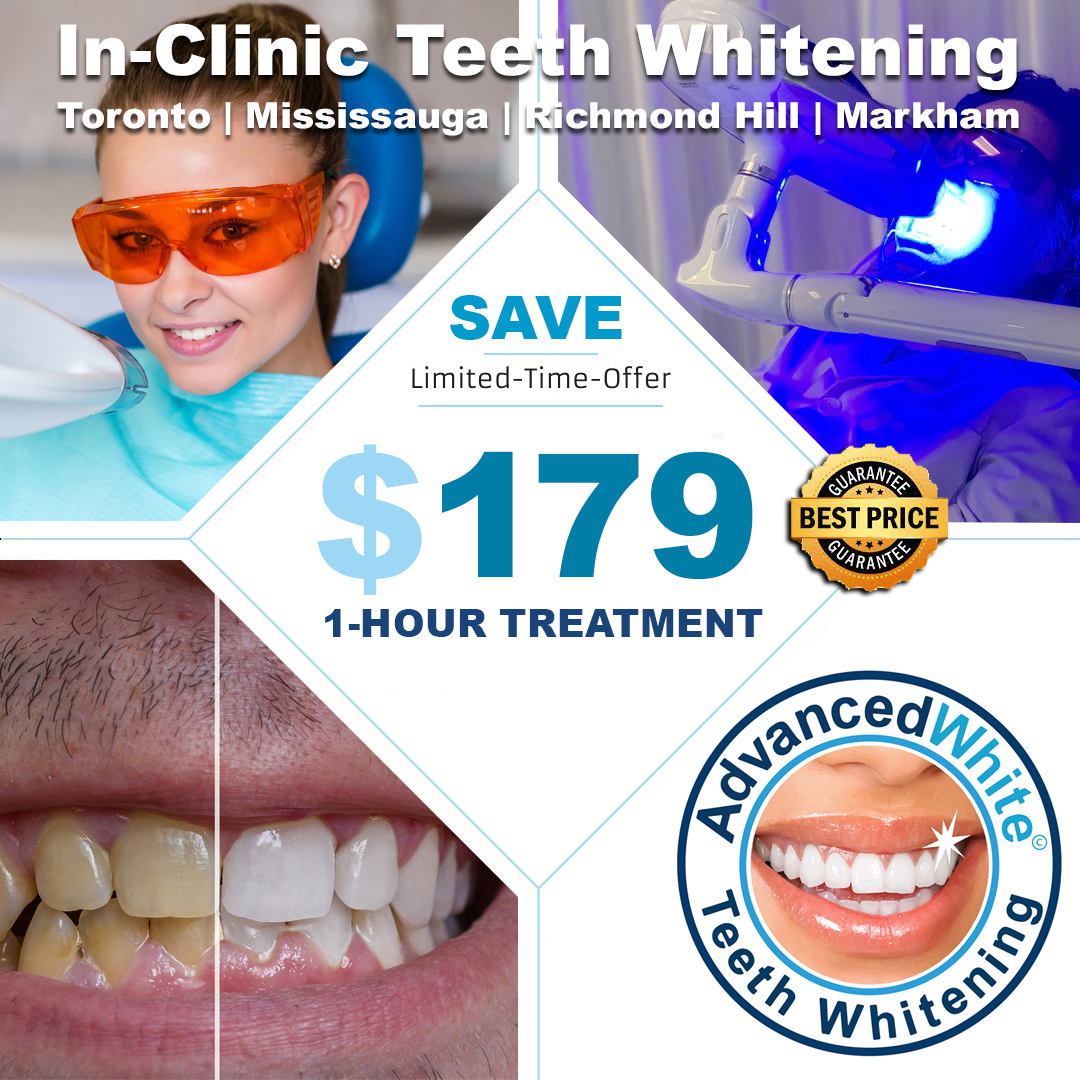 Teeth Whitening Markham