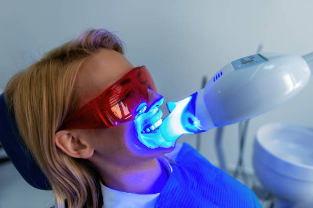 teeth whitening Toronto