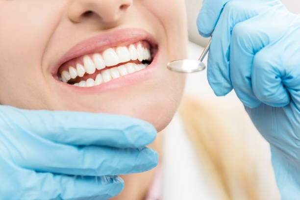 teeth whitening dentist
