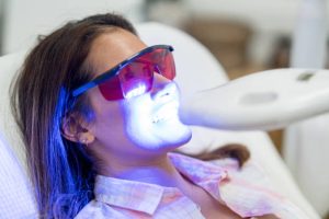 teeth whitening service - Toronto