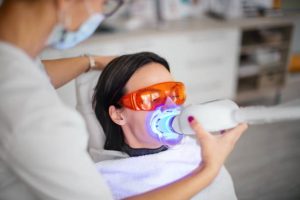 laser teeth whitening Mississauga - dental offices in Mississauga