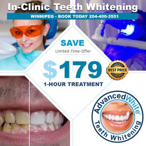 Teeth-Whitening-Winnipeg Professional Teeth Whitening Near Me