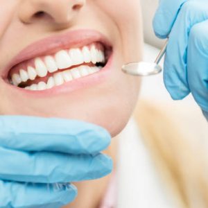laser-teeth-whitening-professional-teeth-whitening-toronto