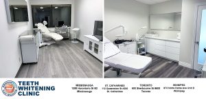 best-teeth-whitening-teeth-whitening-Toronto