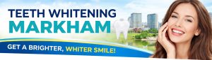 teeth-whitening-markham-teeth-whitening-thornhill-ontario