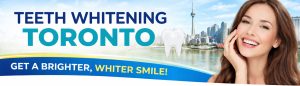 teeth-whitening-toronto